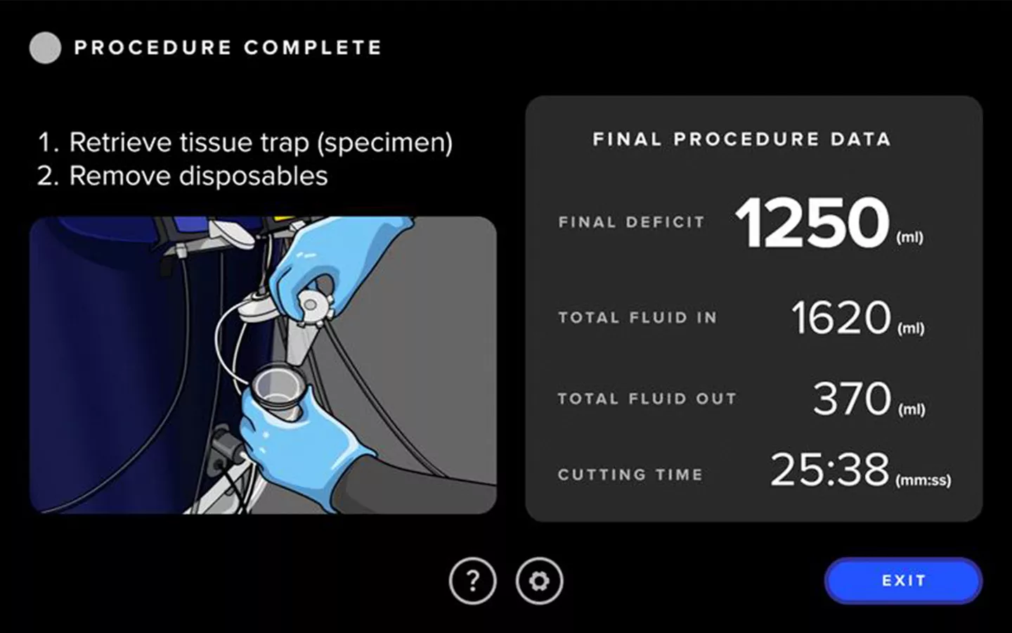 Screenshot from the Fluent Pro Fluid Management System user interface showing the procedure summary.